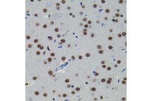 Immunohistochemistry (IHC) image for anti-SMAD, Mothers Against DPP Homolog 5 (SMAD5) (AA 140-240) antibody (ABIN1682808)