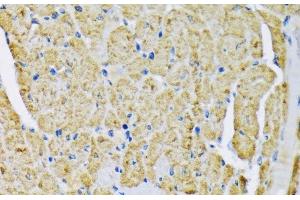 Immunohistochemistry of paraffin-embedded Mouse heart using HK2 Polyclonal Antibody at dilution of 1:200 (40x lens). (Hexokinase 2 antibody)