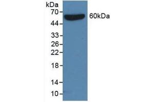 Detection of Recombinant Protein RPC830Hu02 with S-tag using Anti-S15 Oligopeptide (S) Tag Monoclonal Antibody (S15 Oligopeptide antibody)