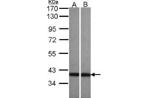 WB Image Sample(30 μg of whole cell lysate) A: A431 , B: HeLaS3 7. (ADAP1 antibody  (C-Term))