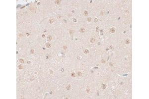 Immunohistochemistry of paraffin-embedded Mouse brain using HMGN1 Polyclonal Antibody at dilution of 1:100 (40x lens).