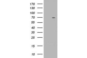 Western Blotting (WB) image for anti-Tripartite Motif Containing 2 (TRIM2) (AA 1-100), (AA 645-744) antibody (ABIN1490542) (TRIM2 antibody  (AA 1-100, AA 645-744))