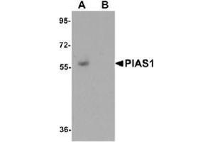 Western blot analysis of PIAS1 in human kidney tissue lysate with PIAS1 antibody at 1 μg/ml in (A) the absence and (B) the presence of blocking peptide. (PIAS1 antibody  (C-Term))