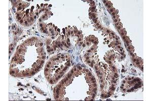 Immunohistochemistry (IHC) image for anti-Leucine Carboxyl Methyltransferase 1 (LCMT1) antibody (ABIN1499109)