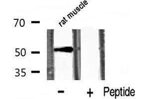 Western blot analysis of p53 phosphorylation expression in rat muscle lysates,The lane on the right is treated with the antigen-specific peptide. (p53 antibody  (pSer20))