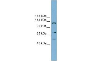 WB Suggested Anti-VARS2 Antibody Titration: 0. (Valyl-tRNA Synthetase 2, Mitochondrial (VARS2) (Middle Region) antibody)