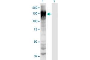Western Blot analysis of MYO1E expression in transfected 293T cell line by MYO1E monoclonal antibody (M02), clone 7A5.