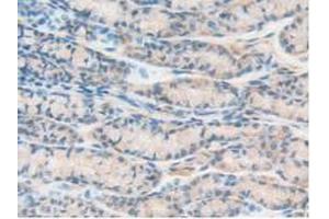IHC-P analysis of Mouse Intestine Tissue, with DAB staining. (PTPRJ antibody  (AA 567-842))
