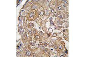 Image no. 3 for anti-Toll-Like Receptor 6 (TLR6) (C-Term) antibody (ABIN357053) (TLR6 antibody  (C-Term))