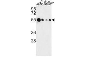 Western blot analysis of AIM2 Antibody (N-term) in MCF-7, HL-60, K562, Hela cell line lysates (35 µg/lane). (AIM2 antibody  (N-Term))