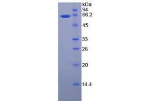 Image no. 1 for Matrix Metalloproteinase 2 (MMP2) (AA 110-660) (Active) protein (His tag) (ABIN6239740) (MMP2 Protein (AA 110-660) (His tag))