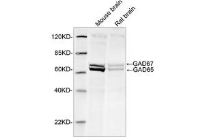 Western blot analysis of tissue lysates using 1 µg/mL Rabbit Anti-GAD65+GAD67 Polyclonal Antibody (ABIN398919) The signal was developed with IRDyeTM 800 Conjugated Goat Anti-Rabbit IgG. (GAD65+GAD67 (AA 550-600) antibody)
