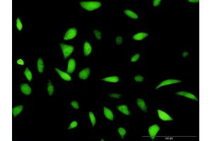 Immunofluorescence of purified MaxPab antibody to HDAC2 on HeLa cell. (HDAC2 antibody  (AA 1-582))