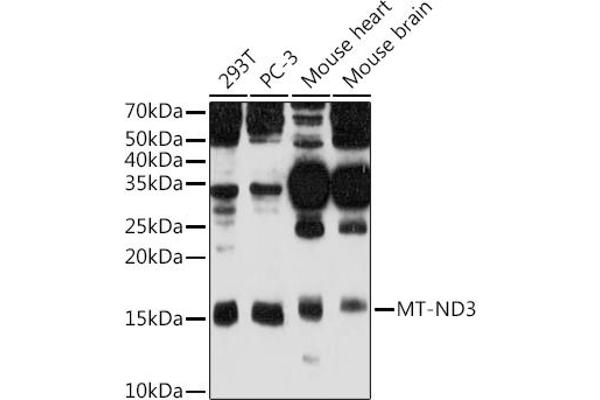 MT-ND3 anticorps