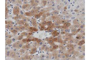 Immunohistochemical staining of paraffin-embedded Human liver tissue using anti-PTPRE mouse monoclonal antibody.