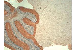 Immunohistochemistry (IHC) image for anti-Inositol 1,4,5-Trisphosphate Receptor, Type 1 (ITPR1) (C-Term) antibody (ABIN6658135)