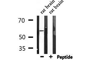Western blot analysis of extracts from rat brain, using Phospho-ATF2 (Ser62/44) Antibody. (ATF2 antibody  (pSer44, pSer62))