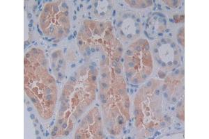 IHC-P analysis of Kidney tissue, with DAB staining. (RIPK2 antibody  (AA 432-540))