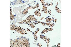 IHC analysis of ICAM1 using anti-ICAM1 antibody (ABIN5692991).