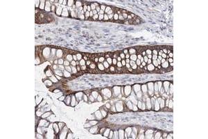 Immunohistochemical staining of human rectum with ARHGAP44 polyclonal antibody  shows strong cytoplasmic positivity in glandular cells. (ARHGAP44 antibody)