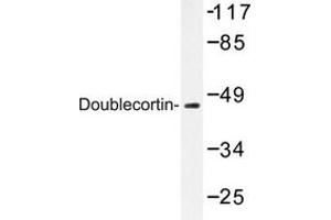 Image no. 2 for anti-Doublecortin (DCX) antibody (ABIN272098) (Doublecortin antibody)