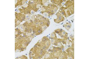 Immunohistochemistry of paraffin-embedded human stomach using NAT8 antibody. (NAT8 antibody)