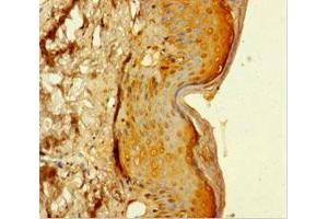 Immunohistochemistry of paraffin-embedded human skin tissue using ABIN7159033 at dilution of 1:100 (MAML1 antibody  (AA 1-45))