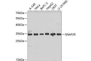 Western blot analysis of extracts of various cell lines using SNAP29 Polyclonal Antibody at dilution of 1:1000. (SNAP29 antibody)