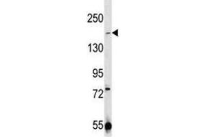 TRPM7 antibody western blot analysis in 293 lysate