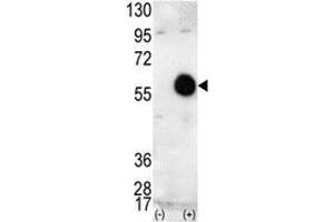 Western blot analysis of AKT2 antibody and 293 cell lysate (2 ug/lane) either nontransfected (Lane 1) or transiently transfected with the human gene (2).