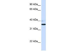 Western Blotting (WB) image for anti-UDP-Gal:betaGlcNAc beta 1,3-Galactosyltransferase, Polypeptide 1 (B3GALT1) (N-Term) antibody (ABIN635749)