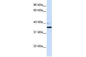 B3GALT1 antibody used at 1 ug/ml to detect target protein. (B3GALT1 antibody  (N-Term))