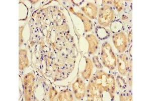 Immunohistochemistry of paraffin-embedded human kidney tissue using ABIN7161762 at dilution of 1:100 (NFIX antibody  (AA 201-440))