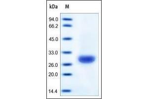 Human Carbonic Anhydrase II, His Tag on SDS-PAGE under reducing (R) condition. (CA2 Protein (AA 1-260) (His tag))