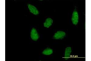 Immunofluorescence of purified MaxPab antibody to NR1H3 on HeLa cell. (NR1H3 antibody  (AA 1-402))