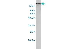 FLNA monoclonal antibody (M01), clone 4E10-1B2 Western Blot analysis of FLNA expression in HL-60 . (Filamin A antibody  (AA 1-838))