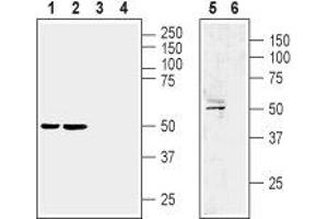 Western blot analysis of rat brain membrane (lane 1 and 3), mouse brain membrane (lanes 2 and 4) and human brain glioblastoma U87 MG cell line (lanes 5 and 6) lysate:  - 1,2,5. (LPAR1 antibody  (Extracellular, N-Term))