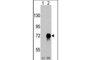 Western blot analysis of RAF1 (arrow) using rabbit polyclonal RAF1 Antibody  (ABIN6243077 and ABIN6579013). (RAF1 antibody  (AA 599-628))