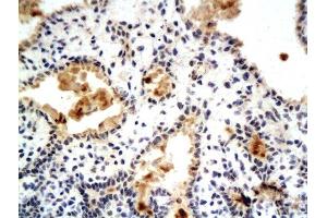 Formalin-fixed and paraffin embedded rat breast tissue labeled with Anti-Phospho-Estrogen Receptor alpha (Ser104/106) Polyclonal Antibody, Unconjugated  at 1:200 followed by conjugation to the secondary antibody and DAB staining (Estrogen Receptor alpha antibody  (pSer104, pSer106))