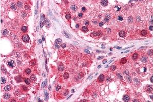 ABIN184781 (2. (TXNRD1 antibody  (C-Term))