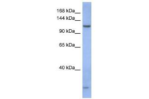 PIWIL1 antibody used at 1 ug/ml to detect target protein. (PIWIL1 antibody)