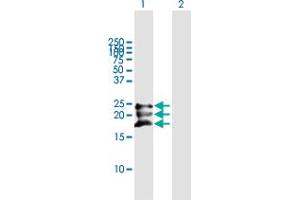 Western Blot analysis of BST2 expression in transfected 293T cell line by BST2 MaxPab polyclonal antibody. (BST2 antibody  (AA 1-180))