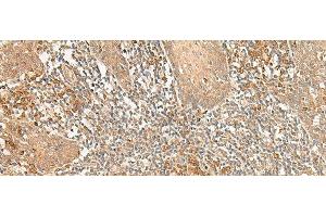 Immunohistochemistry of paraffin-embedded Human tonsil tissue using WLS Polyclonal Antibody at dilution of 1:50(x200) (GPR177/WLS antibody)