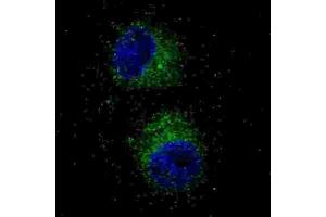 Immunofluorescence (IF) image for anti-Met Proto-Oncogene (MET) antibody (ABIN2995276)