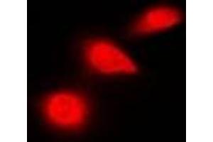 Immunofluorescent analysis of p53 staining in HeLa cells. (p53 antibody  (C-Term))