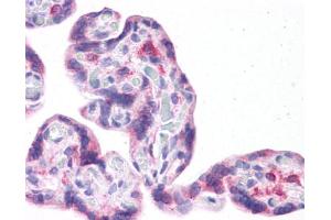 Immunohistochemistry (IHC) image for anti-Leucine Rich Repeat Containing 59 (LRRC59) (Middle Region) antibody (ABIN2783712) (LRRC59 antibody  (Middle Region))