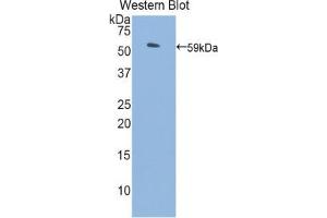 Western blot analysis of the recombinant protein. (PROS1 antibody  (AA 261-496))