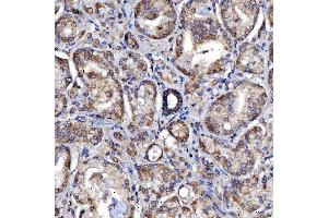 IHC analysis of SARS2 using anti-SARS2 antibody (ABIN7601804). (SARS2 antibody  (AA 46-518))