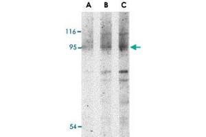 Western blot analysis of NOD2 in Jurkat cell lysate with NOD2 polyclonal antibody  at (A) 1, (B) 2 and (C) 4 ug/mL . (NOD2 antibody  (N-Term))