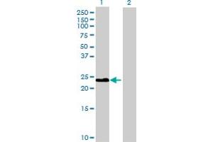 Western Blot analysis of CLEC2B expression in transfected 293T cell line by CLEC2B MaxPab polyclonal antibody. (CLEC2B antibody  (AA 1-149))